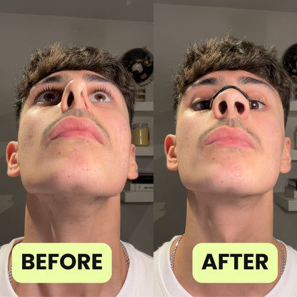 ClearFlow -  Magnetic Nose Strip